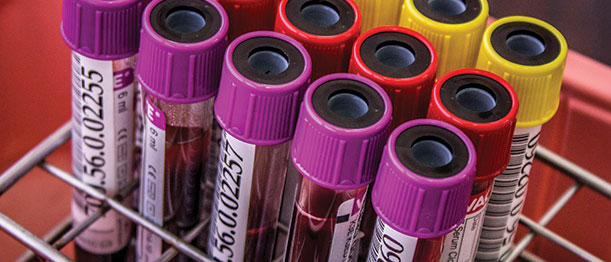 Blood Tests for Cancer